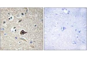 Immunohistochemistry analysis of paraffin-embedded human brain, using TNF12 Antibody.