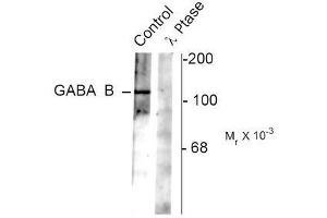 Image no. 1 for anti-gamma-aminobutyric Acid (GABA) B Receptor, 2 (GABBR2) (pSer783) antibody (ABIN372643) (GABBR2 antibody  (pSer783))