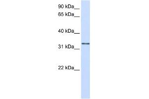 GPSN2 antibody used at 1 ug/ml to detect target protein. (TECR antibody  (C-Term))