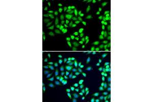 Immunofluorescence analysis of A-549 cells using SGTA antibody. (SGTA antibody  (AA 1-120))
