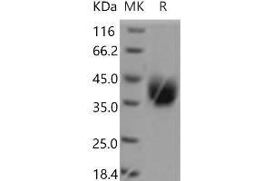 Western Blotting (WB) image for ADP-Ribosyltransferase 4 (Dombrock Blood Group) (ART4) protein (His tag) (ABIN7321097) (ART4 Protein (His tag))