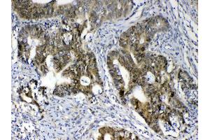 Immunohistochemistry (IHC) image for anti-UDP-Galactose-4-Epimerase (GALE) (AA 1-340) antibody (ABIN5693266)
