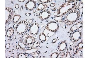 Immunohistochemical staining of paraffin-embedded Human Kidney tissue using anti-TBXAS1 mouse monoclonal antibody. (TBXAS1 antibody)