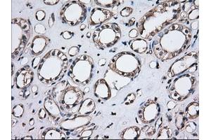 Immunohistochemical staining of paraffin-embedded Human Kidney tissue using anti-TBXAS1 mouse monoclonal antibody.