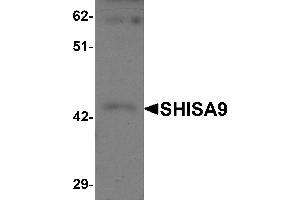 Western Blotting (WB) image for anti-Shisa Homolog 9 (Shisa9) (Middle Region) antibody (ABIN1031091) (Shisa9 antibody  (Middle Region))