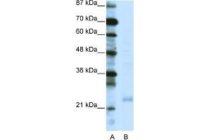 Human Jurkat; WB Suggested Anti-TAF10 Antibody Titration: 0.