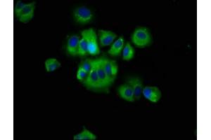 Immunofluorescence staining of MCF-7 cells with ABIN7168026 at 1:66, counter-stained with DAPI. (RHOD antibody  (AA 1-80))