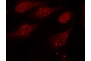 Immunofluorescence staining of methanol-fixed Hela cells, using Phospho-TP53-S315 antibody. (p53 antibody  (pSer315))