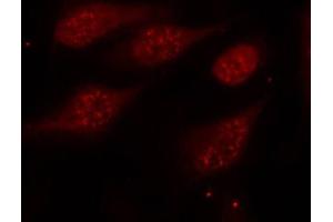 Immunofluorescence staining of methanol-fixed Hela cells, using Phospho-TP53-S315 antibody. (p53 antibody  (pSer315))