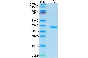 Human FSTL3 on Tris-Bis PAGE under reduced condition. (FSTL3 Protein (AA 27-263) (His tag))