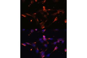 Immunofluorescence analysis of NIH/3T3 cells using CLDN5 antibody (ABIN6127705, ABIN6138692, ABIN6138693 and ABIN6214365) at dilution of 1:100. (Claudin 5 antibody  (AA 230-303))