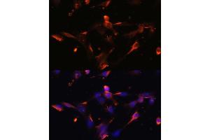 Immunofluorescence analysis of NIH/3T3 cells using CLDN5 antibody (ABIN6127705, ABIN6138692, ABIN6138693 and ABIN6214365) at dilution of 1:100. (Claudin 5 antibody  (AA 230-303))