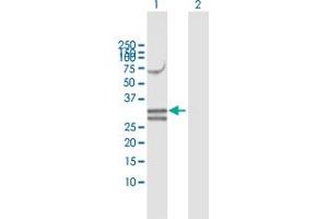 Western Blot analysis of NUDT6 expression in transfected 293T cell line by NUDT6 MaxPab polyclonal antibody. (NUDT6 antibody  (AA 1-316))