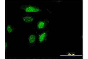 Immunofluorescence of monoclonal antibody to RDH12 on HeLa cell. (RDH12 antibody  (AA 217-316))