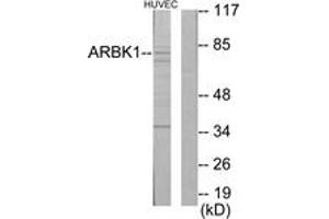 Western Blotting (WB) image for anti-Adrenergic, Beta, Receptor Kinase 1 (ADRBK1) (AA 601-650) antibody (ABIN2889434) (GRK2 antibody  (AA 601-650))