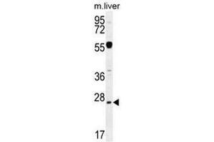 NPS3A Antibody (Center) western blot analysis in mouse liver tissue lysates (35µg/lane). (NIPSNAP3A antibody  (Middle Region))