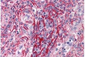 Human Spleen: Formalin-Fixed, Paraffin-Embedded (FFPE) (TBXA2R antibody  (AA 1-15))