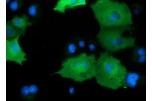 Image no. 14 for anti-DnaJ (Hsp40) Homolog, Subfamily A, Member 2 (DNAJA2) antibody (ABIN1497862) (DNAJA2 antibody)