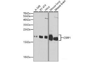 Western blot analysis of extracts of various cell lines using CSRP1 Polyclonal Antibody at dilution of 1:1000. (CSRP1 antibody)