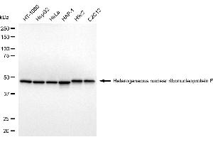 anti-Heterogeneous Nuclear Ribonucleoprotein F (HNRNPF) antibody