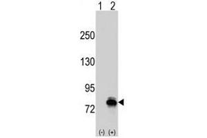 Image no. 1 for anti-K-Cadherin (CDH6) (N-Term) antibody (ABIN356889) (CDH6 antibody  (N-Term))