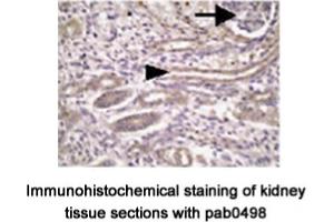 Image no. 2 for anti-Transmembrane Protein 67 (TMEM67) (C-Term) antibody (ABIN347657) (TMEM67 antibody  (C-Term))