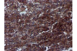 Image no. 5 for anti-Complement Component 1, S Subcomponent (C1S) antibody (ABIN1497565) (C1S antibody)