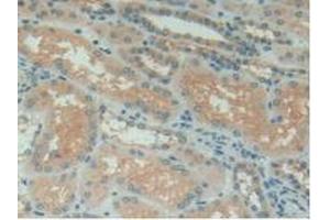 Immunohistochemistry (IHC) image for anti-Serpin Peptidase Inhibitor, Clade G (C1 Inhibitor), Member 1 (SERPING1) (AA 399-500) antibody (ABIN7431428)