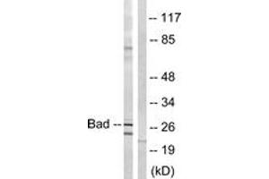 Western blot analysis of extracts from mouse liver cells, using BAD (Ab-134) Antibody.