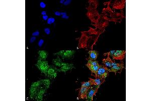 Immunocytochemistry/Immunofluorescence analysis using Rabbit Anti-Calcium Sensing Receptor Polyclonal Antibody . (CASR antibody  (AA 1-100) (HRP))