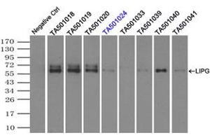 Image no. 1 for anti-Lipase, Endothelial (LIPG) antibody (ABIN1499166) (LIPG antibody)