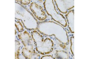 Immunohistochemistry of paraffin-embedded human kidney using PTPRA Antibody (ABIN3015783, ABIN3015784, ABIN1682399 and ABIN6219134) at dilution of 1:100 (40x lens). (PTPRA antibody  (AA 20-142))