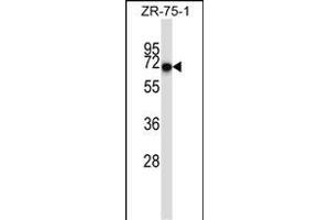 CD5 Antibody (Center) (ABIN657456 and ABIN2846483) western blot analysis in ZR-75-1 cell line lysates (35 μg/lane). (CD5 antibody  (AA 203-232))