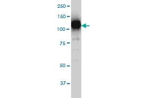 SIRT1 monoclonal antibody (M01), clone 7B7 Western Blot analysis of SIRT1 expression in Hela S3 NE . (SIRT1 antibody  (AA 456-555))