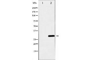 Western blot analysis of BCL-XL expression in UV treated 293 whole cell lysates,The lane on the left is treated with the antigen-specific peptide. (BCL2L1 antibody  (N-Term))