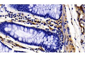 Detection of FGg in Porcine Colon Tissue using Polyclonal Antibody to Fibrinogen Gamma (FGg)
