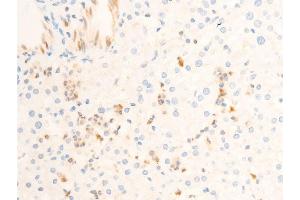 ABIN6267302 at 1/100 staining human liver tissue sections by IHC-P. (ICAM1 antibody  (pTyr512))