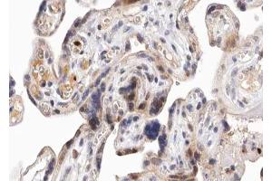 ABIN6267653 at 1/100 staining human Placenta tissue sections by IHC-P. (PKD1/2/3/PKC mu (pSer738), (pSer742) antibody)
