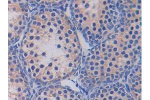 DAB staining on IHC-P; Samples: Mouse Testis Tissue (Fatty Acid Synthase antibody  (AA 2257-2504))