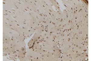 ABIN6279296 at 1/100 staining Mouse liver tissue by IHC-P. (CHD8 antibody  (C-Term))