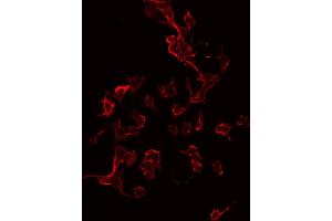 ABIN6267335 staining 293 by IF/ICC. (IGF1R antibody  (pTyr1165, pTyr1166))