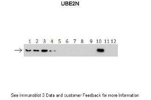 Western Blotting (WB) image for anti-Ubiquitin-Conjugating Enzyme E2N (UBE2N) (Middle Region) antibody (ABIN2778258)