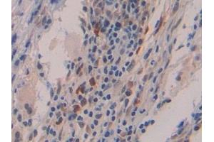 Immunohistochemistry (IHC) image for anti-Interferon, beta 1, Fibroblast (IFNB1) (AA 22-187) antibody (ABIN7431356)