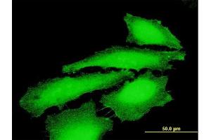 Immunofluorescence of purified MaxPab antibody to MAGEE1 on HeLa cell. (MAGEE1 antibody  (AA 1-957))