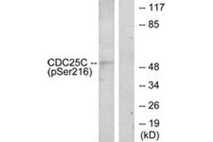 Western blot analysis of extracts from HuvEc cells treated with serum 20% 30', using CDC25C (Phospho-Ser216) Antibody. (CDC25C antibody  (pSer216))