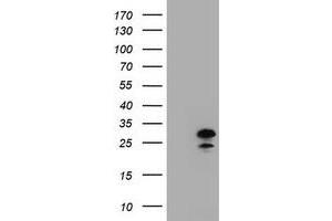 Image no. 2 for anti-Zinc Finger, AN1-Type Domain 5 (ZFAND5) antibody (ABIN1501812) (ZFAND5 antibody)