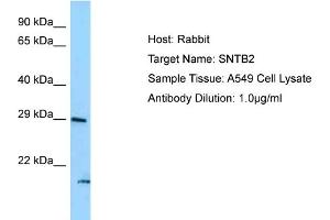 Host: Rabbit Target Name: SNTB2 Sample Type: A549 Whole Cell lysates Antibody Dilution: 1. (SNTB2 antibody  (N-Term))