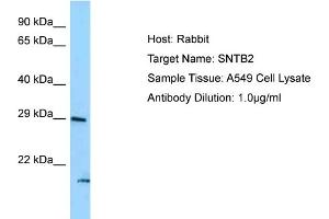 Host: Rabbit Target Name: SNTB2 Sample Type: A549 Whole Cell lysates Antibody Dilution: 1.