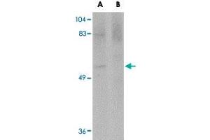 Western blot analysis of MATN4 in rat brain tissue lysate with MATN4 polyclonal antibody  at 1 ug/mL in (A) the absence and (B) the presence of blocking peptide. (MATN4 antibody  (N-Term))