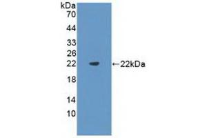 FLT3LG anticorps  (AA 27-189)